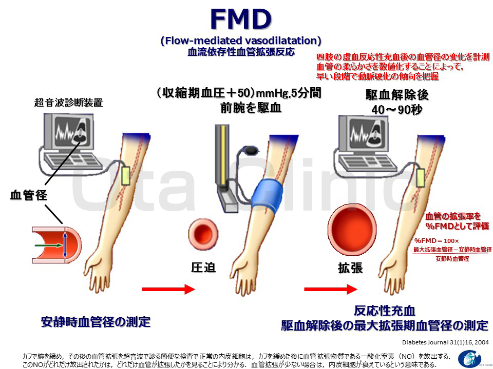 FMD検査