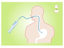 胃内バルーン治療ダイエット | おおた内科消化器科クリニック