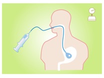 胃内バルーン治療ダイエット | おおた内科消化器科クリニック