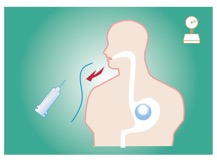 胃内バルーン治療ダイエット おおた内科消化器科クリニック